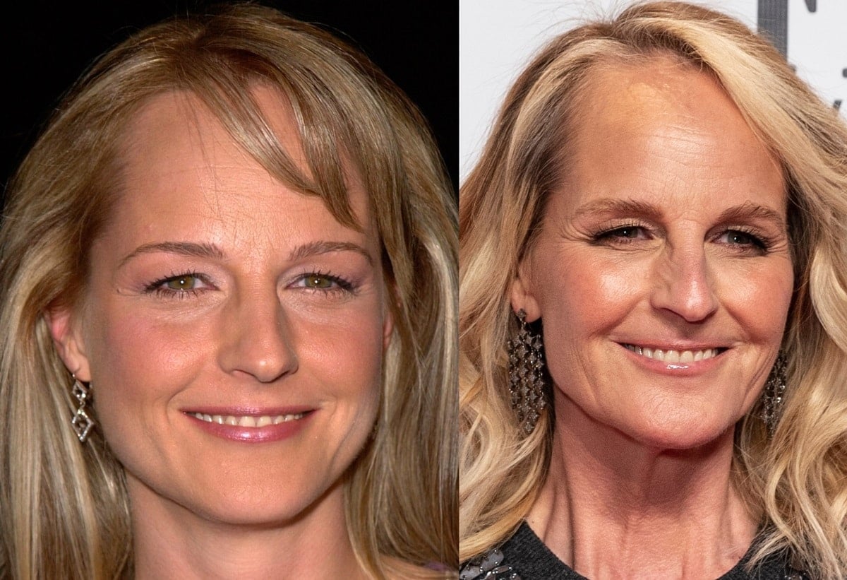 Helen Hunt in 2010 (L) and 2021 (R): Over the years, fans have engaged in speculation regarding Helen Hunt's potential involvement in cosmetic procedures