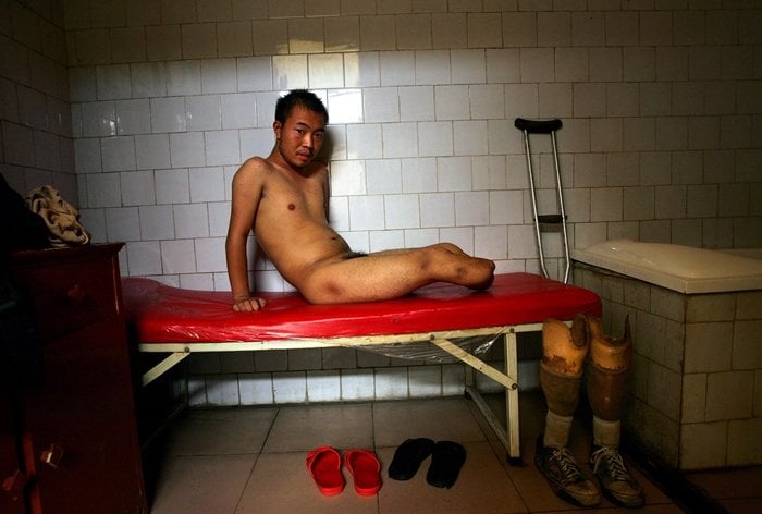 Zhang Xubo was forced to work in freezing conditions in Shaanxi, China, and lost his legs after being imprisoned as a slave in an illegal factory