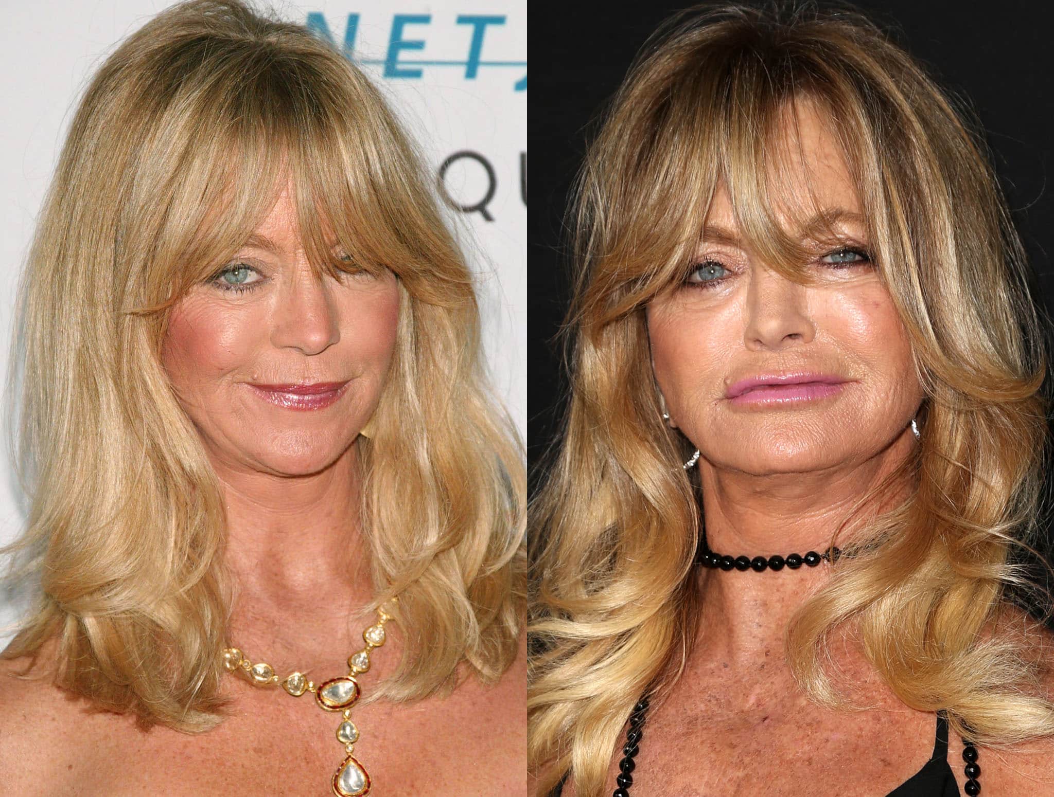 Goldie Hawn before (in 2007) and after (in 2015) plastic surgery rumors