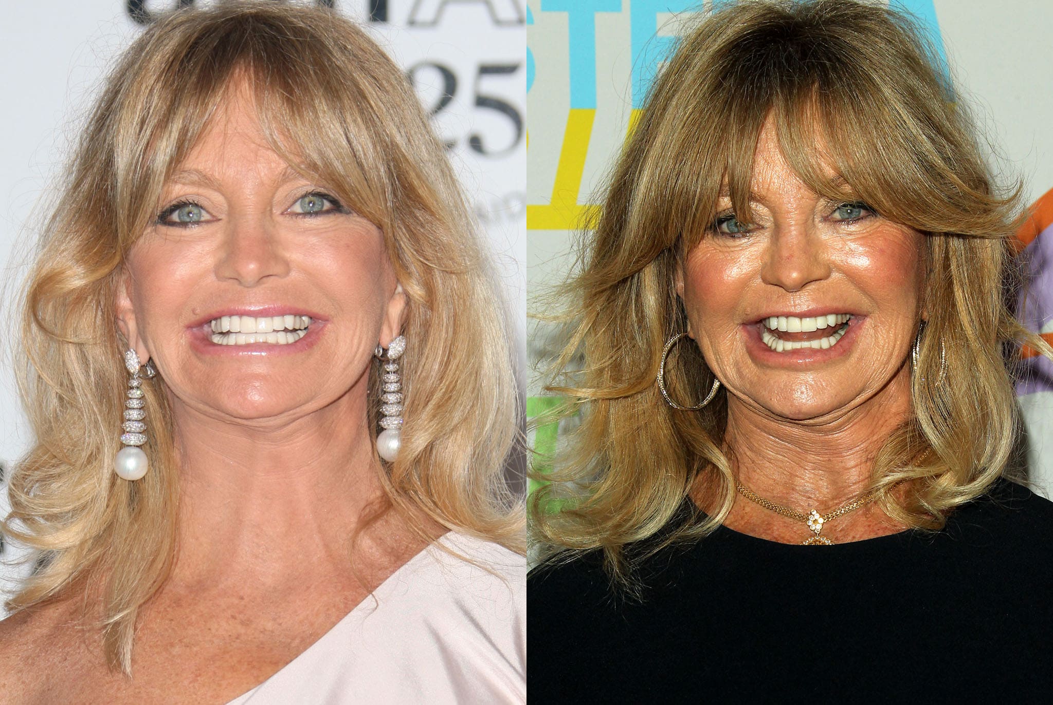 Goldie Hawn before (left) and after (right) plastic surgery rumors