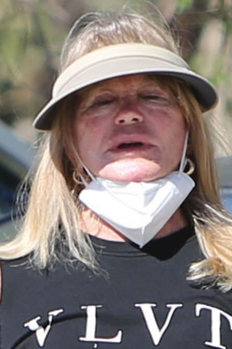 Did Goldie Hawn Get Plastic Surgery Face Before And After 