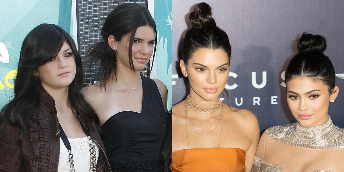 Pictured in 2009 (L) and 2017, Kendall and Kylie Jenner both deny they've had plastic surgery