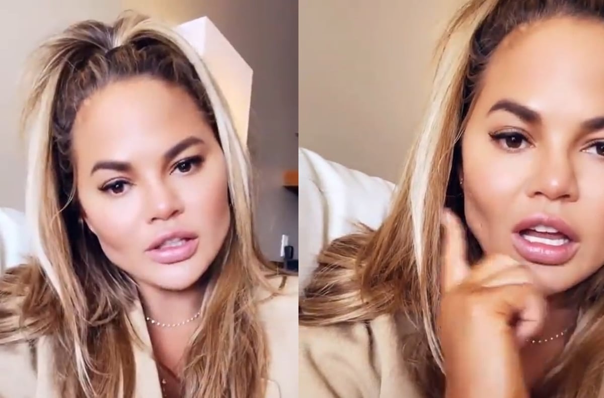 Chrissy Teigen underwent a buccal fat removal procedure to have fat removed from her cheeks