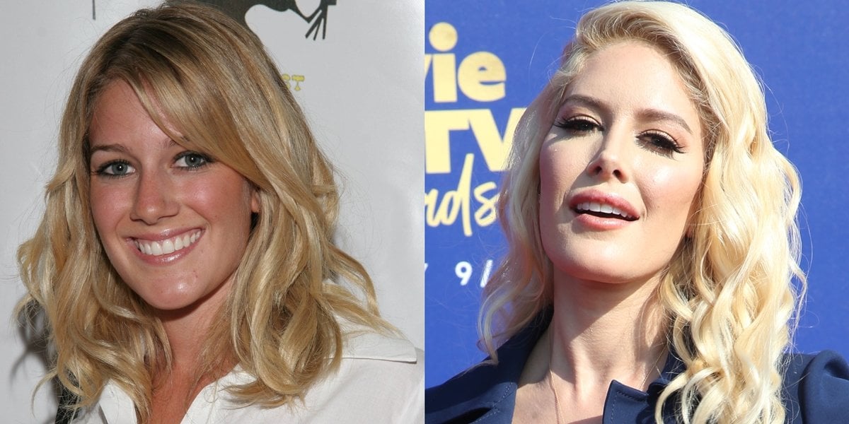 Before-and-after plastic surgery transformation: Heidi Montag in 2006 (L) and 2019