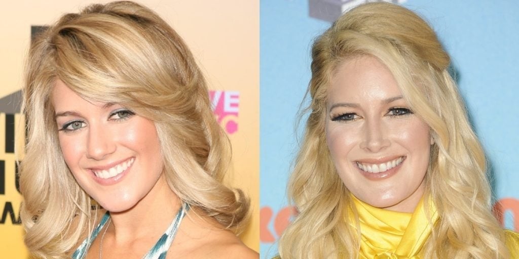 Heidi Montag's Plastic Surgery A Look at Her Before and After Photos
