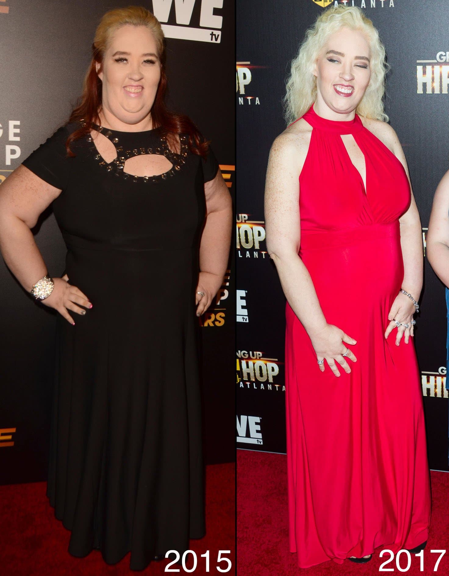 Mama June Shannon once weighed 460 pounds but lost 300 following a gastric sleeve surgery in 2016 and later a tummy tuck