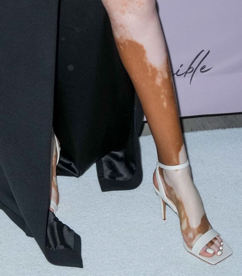 Winnie Harlow slips her pedicured feet into Vince Camuto's Saprenda2 white heels