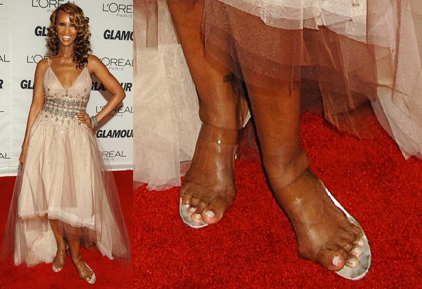 Iman's feet appear to show signs of swelling, possibly from the tightness of her clear sandals, which seem to be pressing against her skin, contributing to visible discomfort