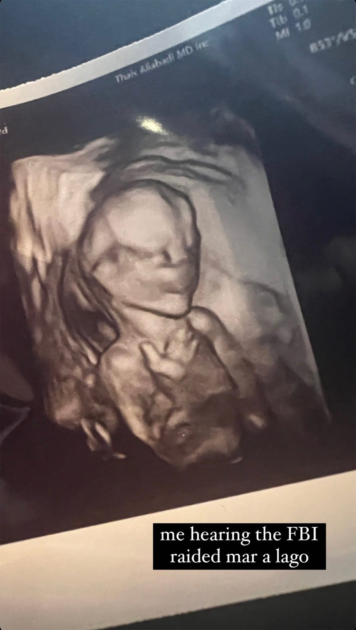 Chrissy Teigen shares an ultrasound image of her third baby and references news about Trump's Mar-A-Lago estate raid in her caption