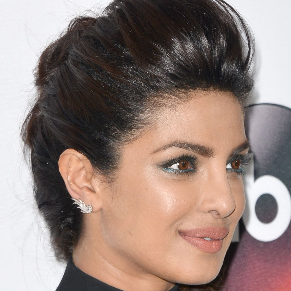 Priyanka Chopra Chopra needed to have a polyp surgically removed from her nasal cavity