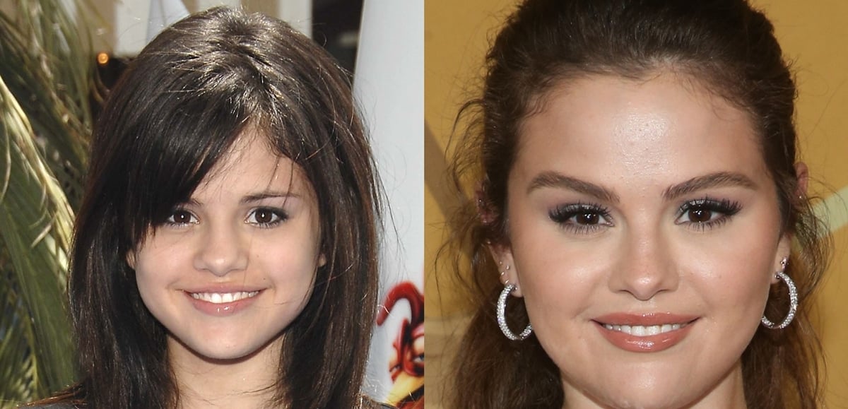 Before and after rumored plastic surgery: Selena Gomez's face in 2007 and 2022