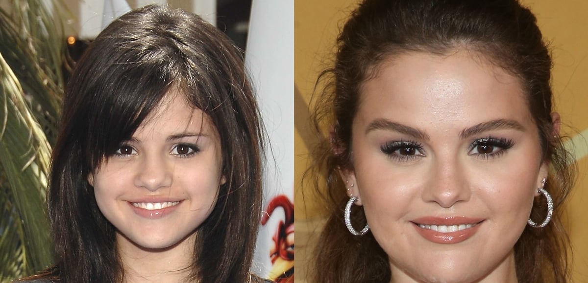 Selena Gomez Plastic Surgery Boob Job Nose Job Botox My XXX Hot Girl