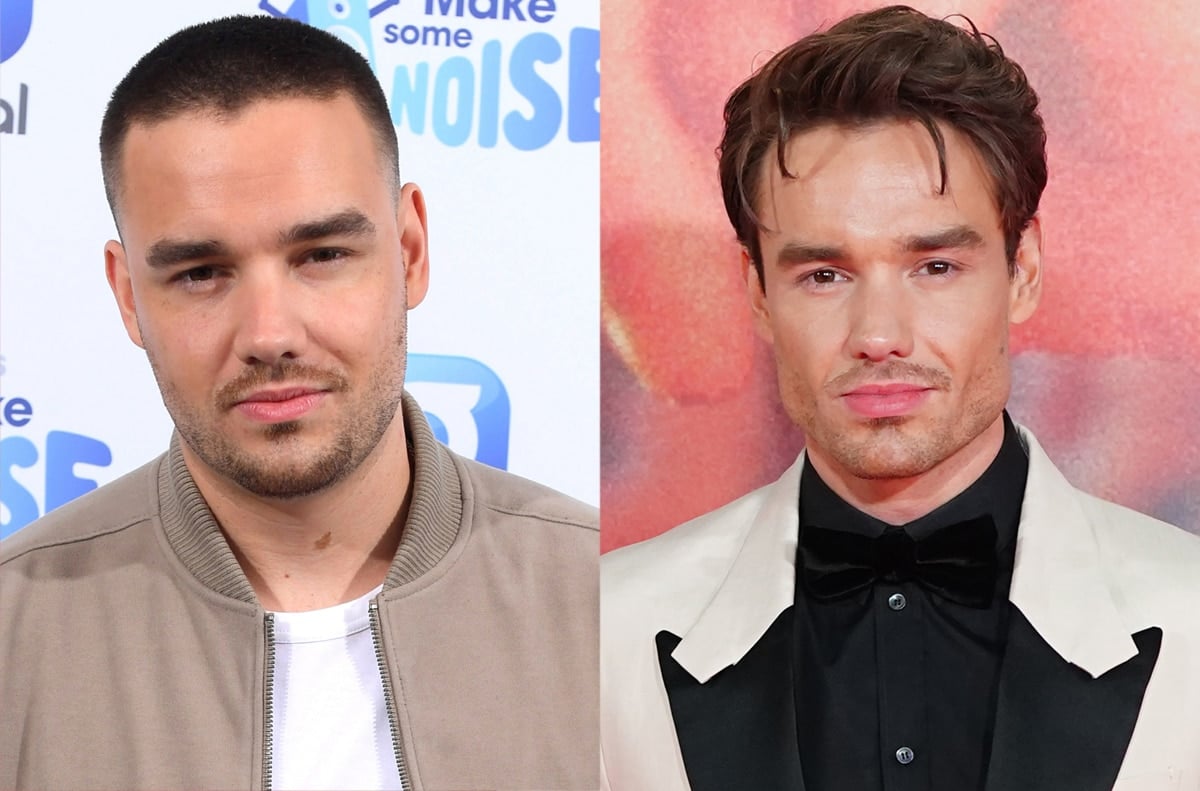 Liam Payne before (2021) and after (2023) his rumored buccal fat surgery procedure