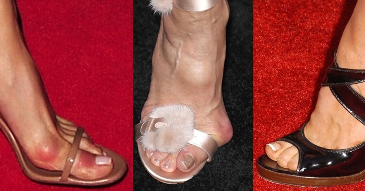 Are High Heels Bad for You? 6 Health Risks to Consider