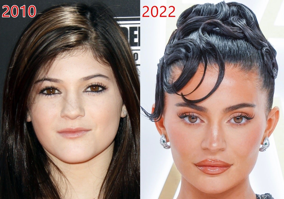 Fans speculate that Kylie Jenner has had work done on her eyes, nose, cheek fillers, teeth, and even her body